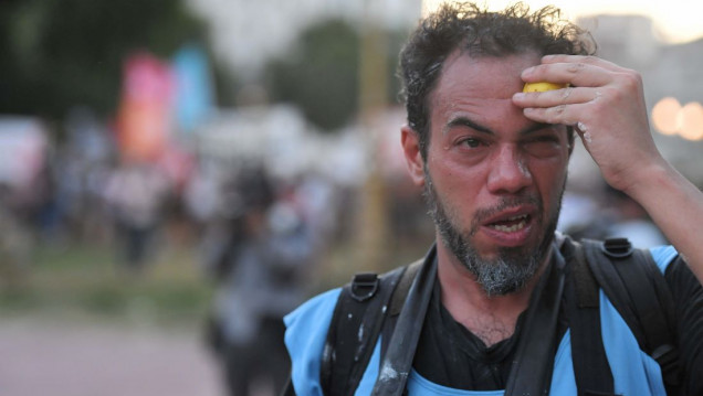 imagen Alerta por trabajadores de prensa heridos durante la represión frente al Congreso 