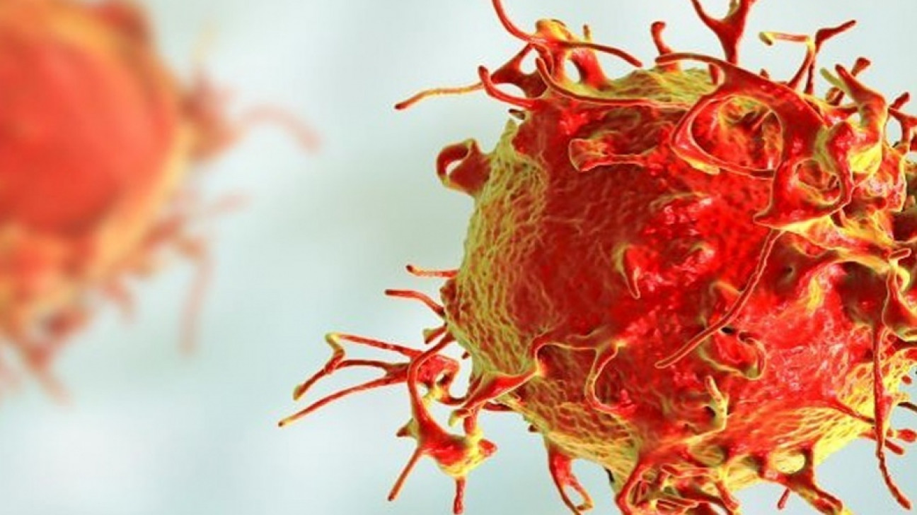 imagen En 30 años, el diagnóstico de la leucemia más frecuente en hombres aumentó el 35%