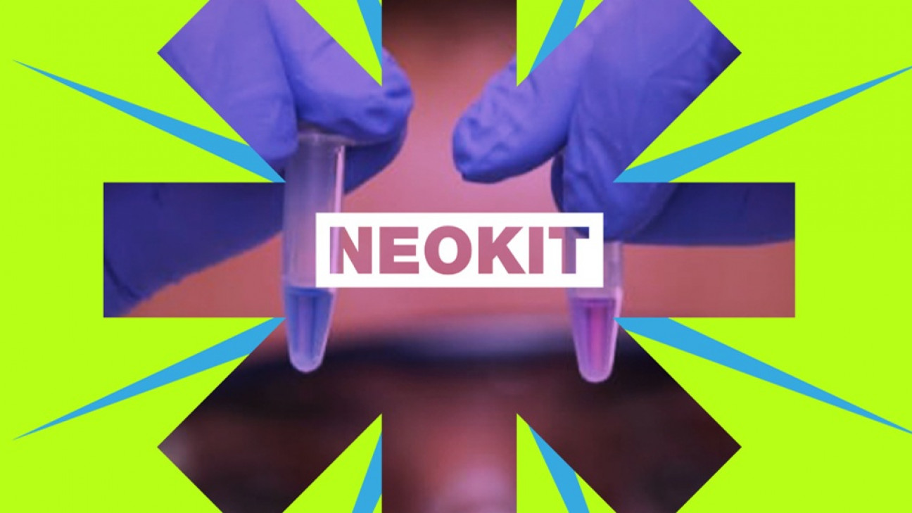 imagen Conicet desarrolla test simples y económicos para detectar chagas, dengue y covid-19