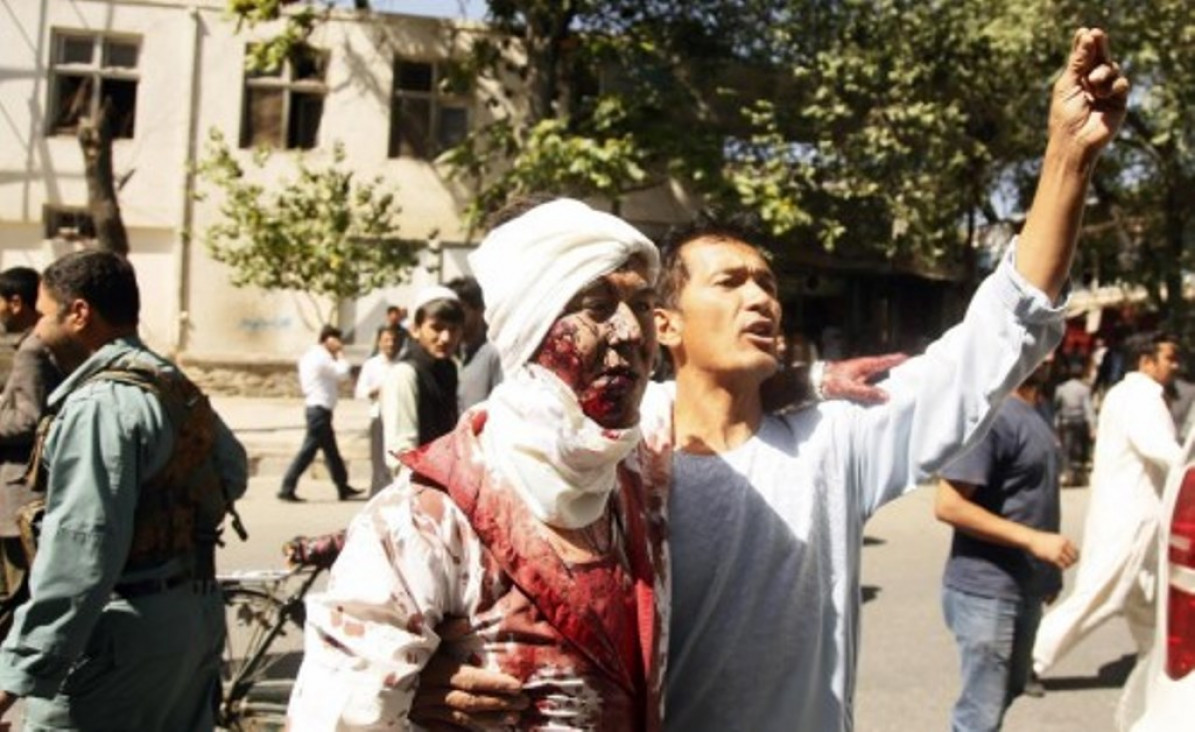 imagen Terror en Kabul: 90 muertos y 350 heridos tras la explosión de un camión bomba