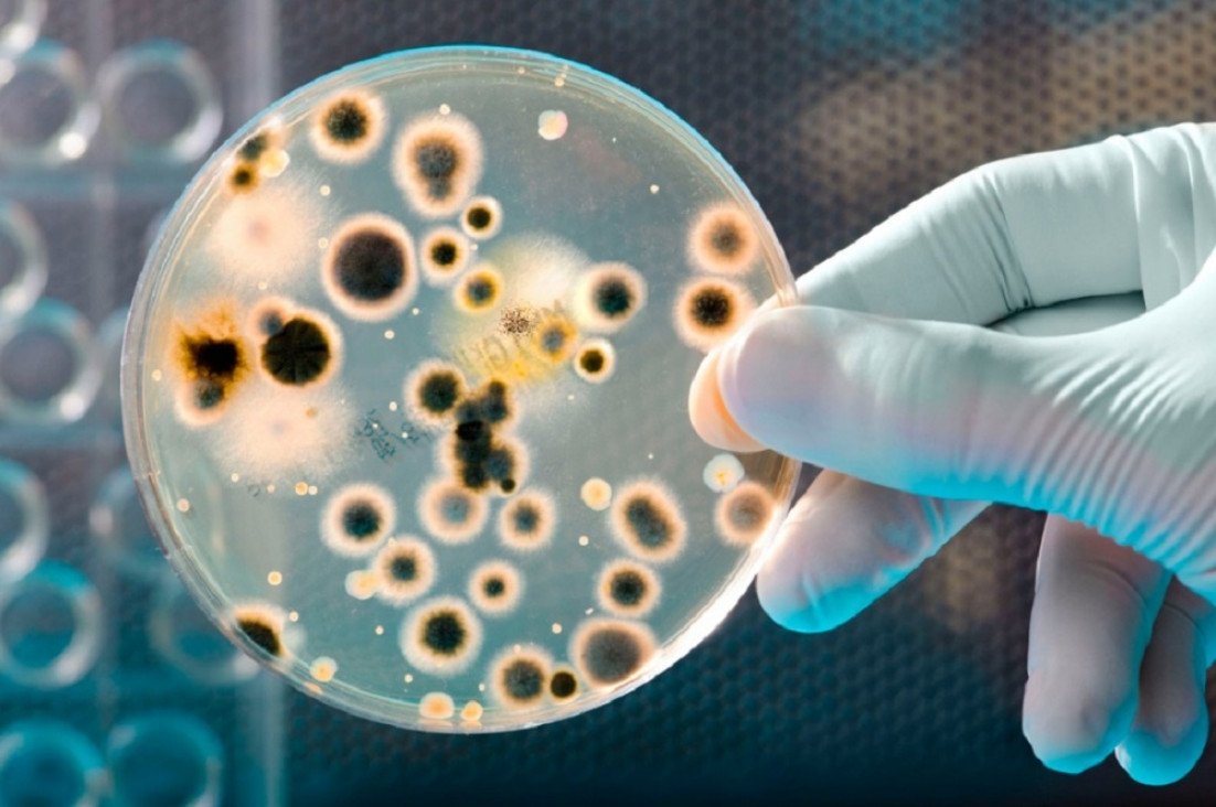 imagen Realizaron en Argentina un estudio sobre mortalidad por bacterias resistentes a medicamentos