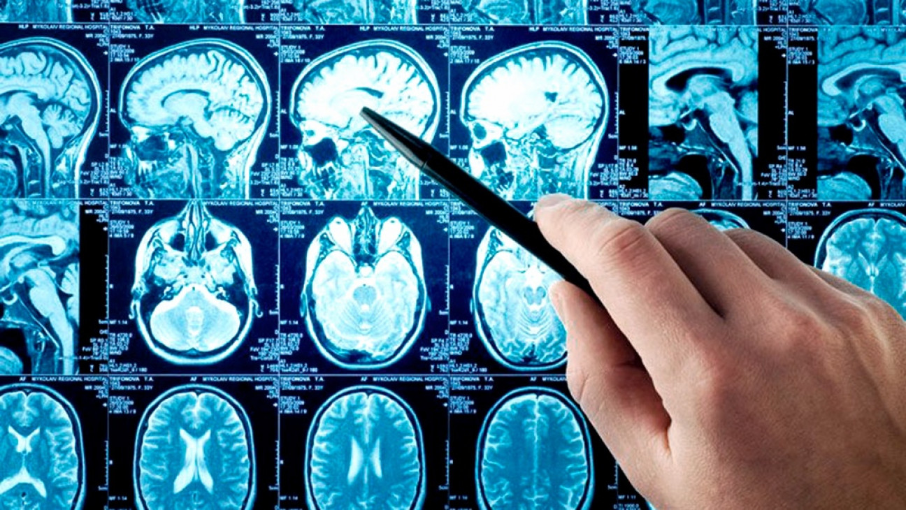 imagen Científicos argentinos crearon un asistente virtual móvil para reconocer síntomas de ACV