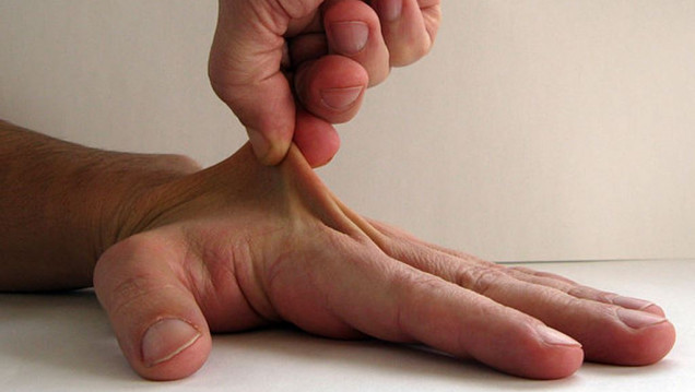 imagen Una rara enfermedad, mal diagnosticada 