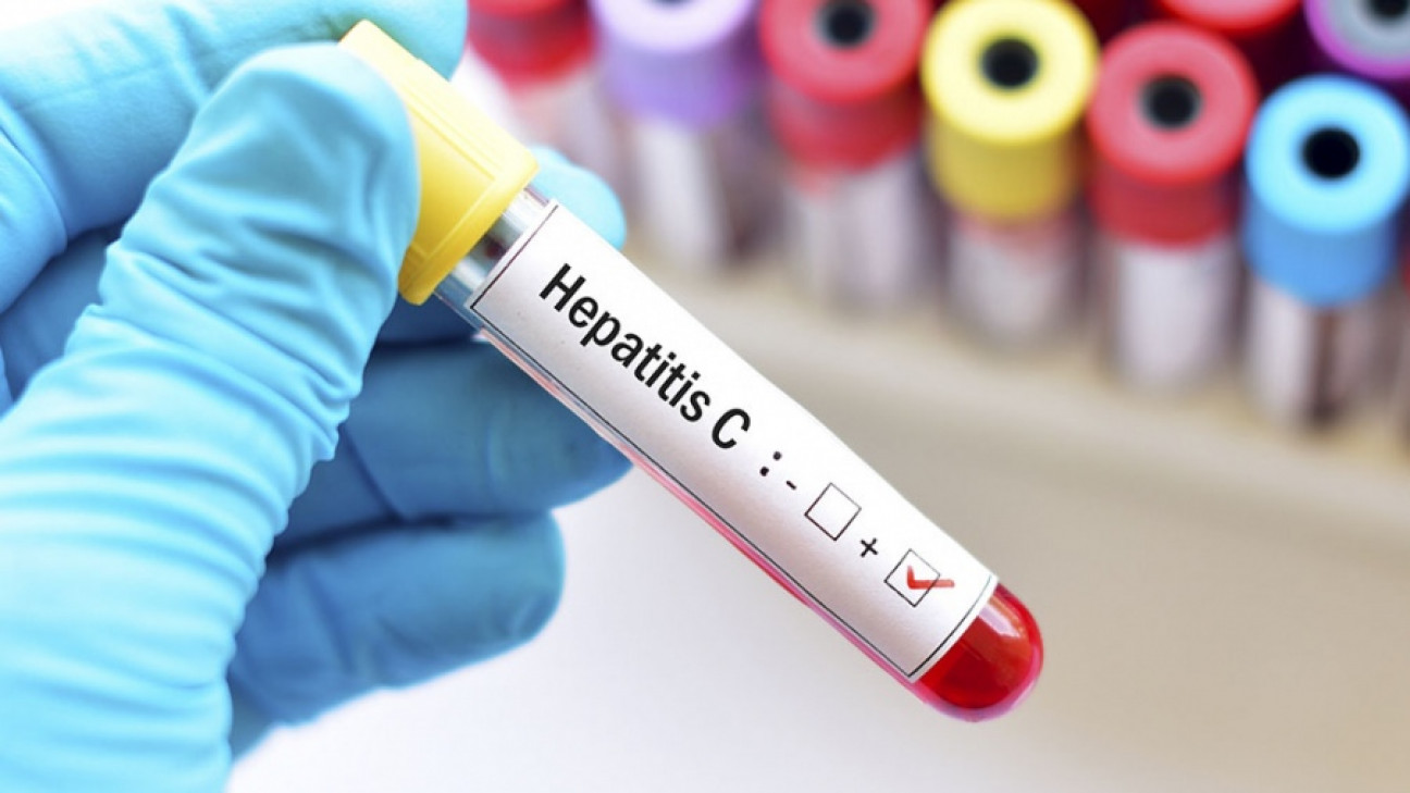 imagen Solo el 18% de las personas diagnosticadas con hepatitis B y C realizan tratamiento 