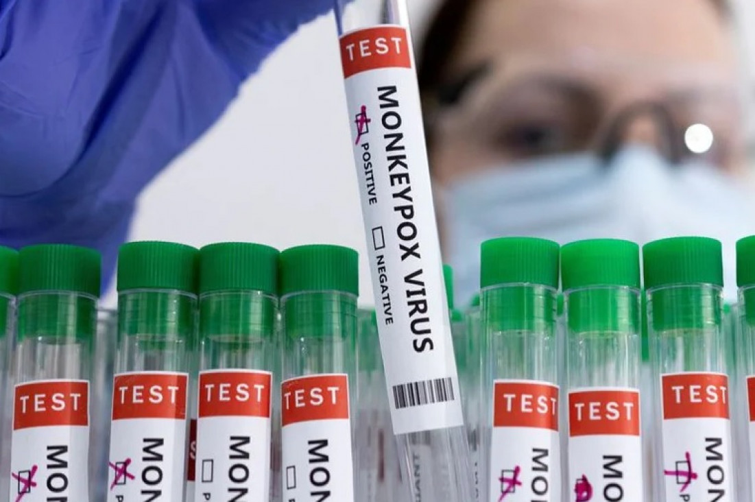 imagen El Ministerio de Salud confirmó el primer caso argentino de la viruela del mono