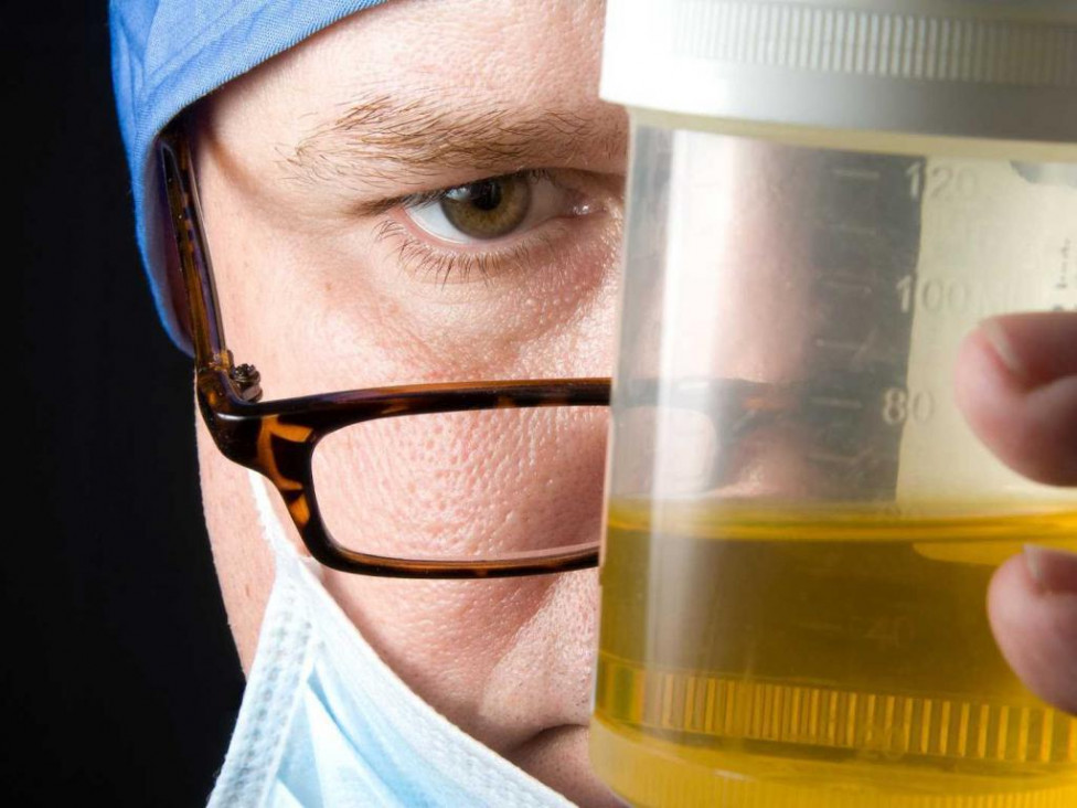 imagen Un año después del arribo de un laboratorio, regularán colecta de orina