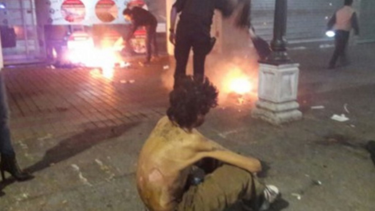 imagen El hombre quemado está fuera de peligro y se fue por voluntad propia del hospital