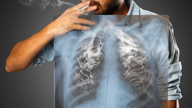 imagen En Argentina, hay casi 45 mil muertos por año debido al consumo de tabaco