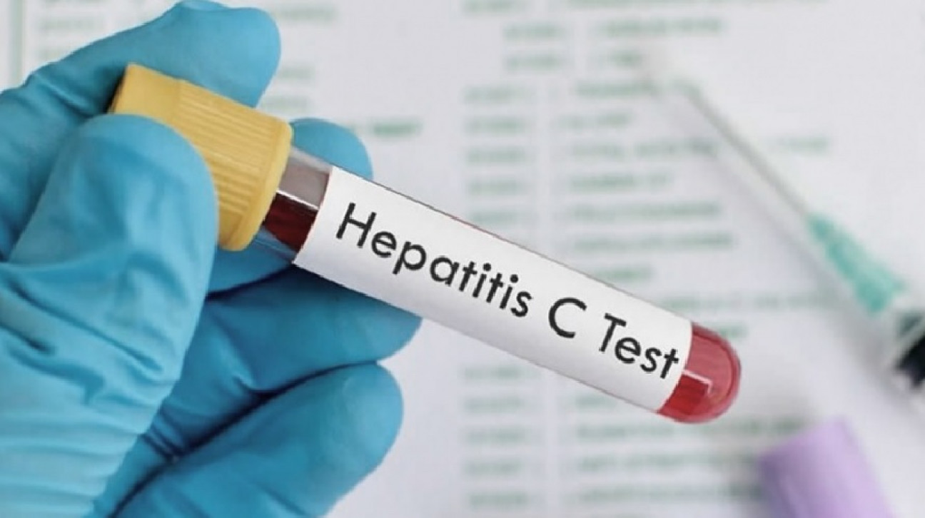 imagen Salud detectó el primer caso de hepatitis aguda grave en el país