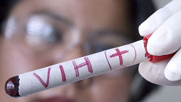 imagen Mendoza ya utiliza un nuevo método para prevenir el VIH 